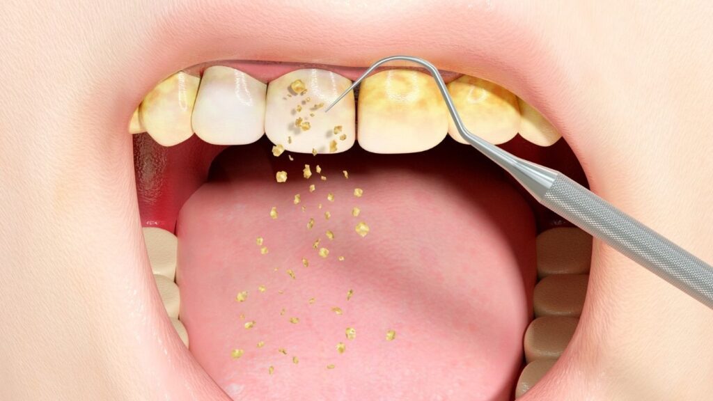 Cleopatra Dental Alanya - Alanya Dental