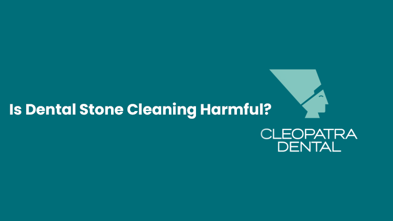 Is Dental Stone Cleaning Harmful?