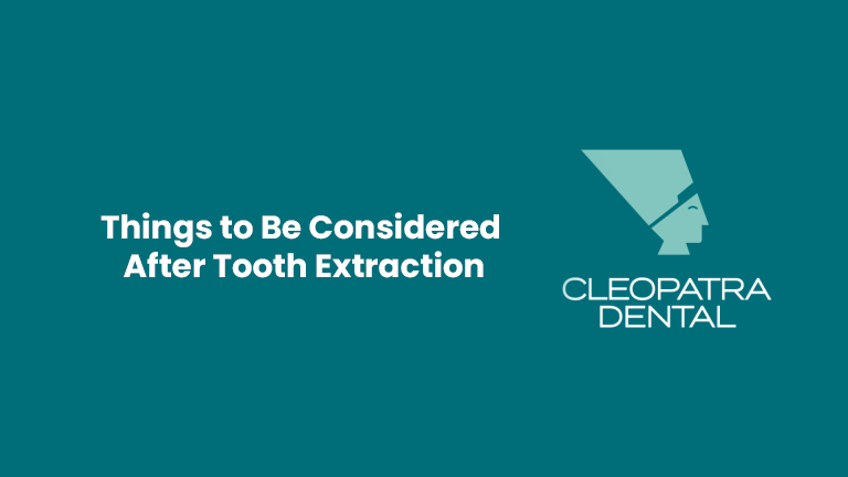 Things to Be Considered After Tooth Extraction
