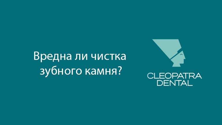 Вредна ли чистка зубного камня?