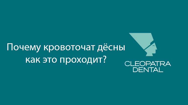 Почему кровоточат дёсны, как это проходит?