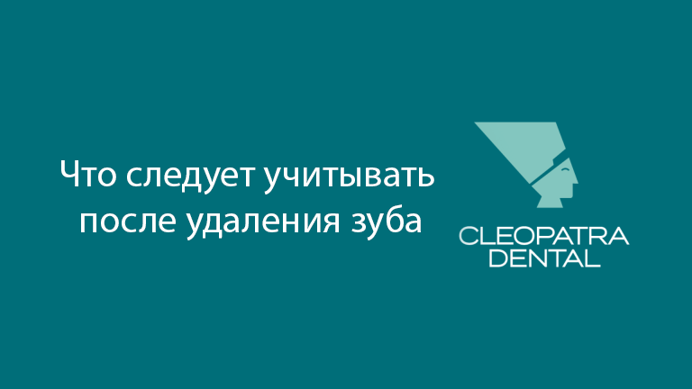 Что следует учитывать после удаления зуба